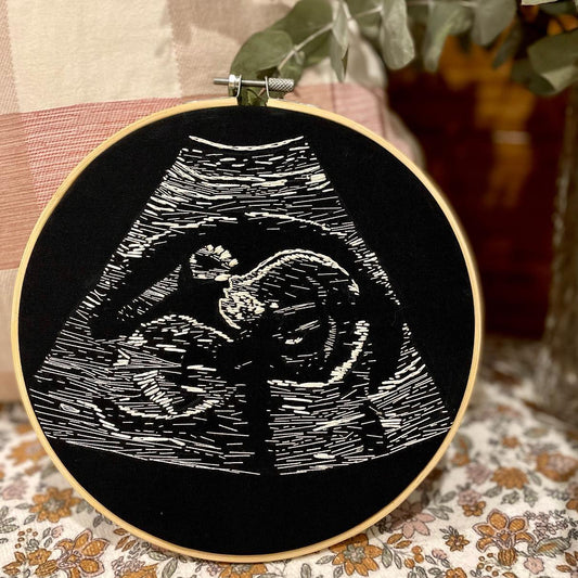 Ultrasound Embroidery Hoop